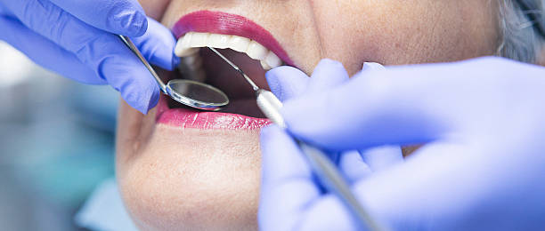 Best Emergency Tooth Extraction in Warrenton, OR